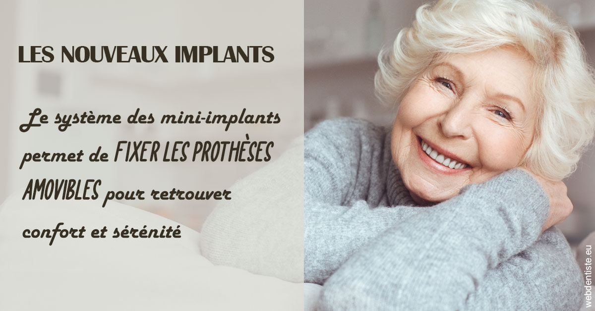 https://dr-lartaud-jean-marc.chirurgiens-dentistes.fr/Les nouveaux implants 1