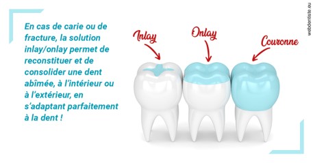 https://dr-lartaud-jean-marc.chirurgiens-dentistes.fr/L'INLAY ou l'ONLAY