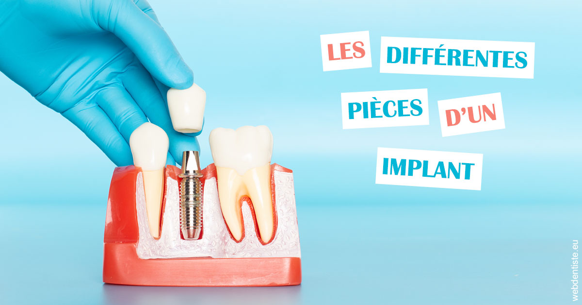 https://dr-lartaud-jean-marc.chirurgiens-dentistes.fr/Les différentes pièces d’un implant 2
