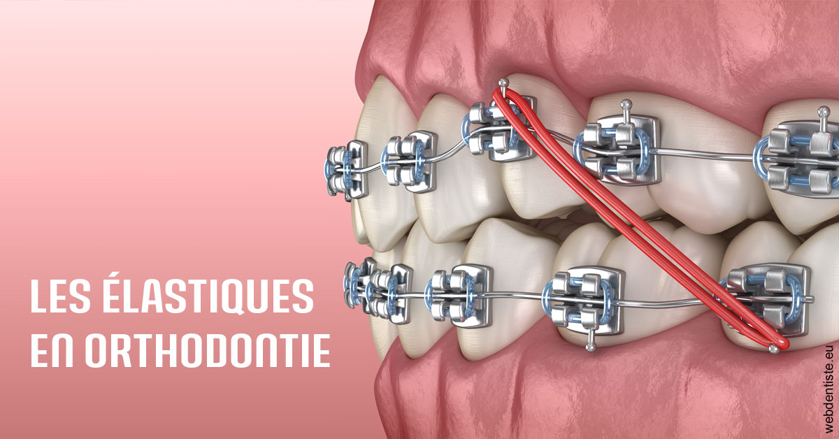 https://dr-lartaud-jean-marc.chirurgiens-dentistes.fr/Elastiques orthodontie 2