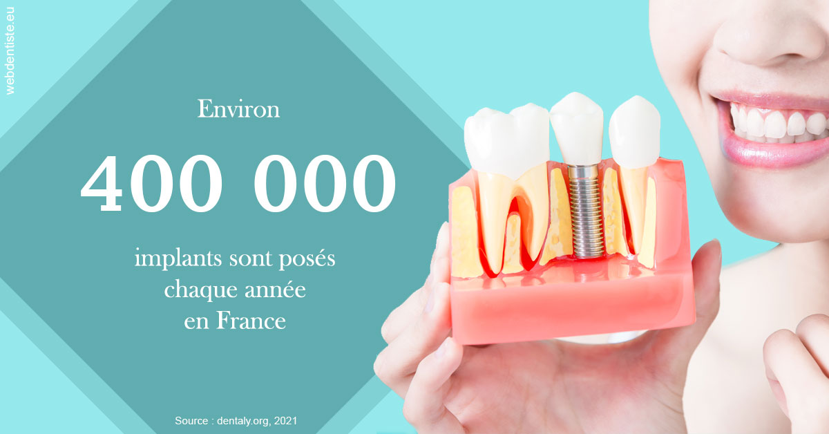https://dr-lartaud-jean-marc.chirurgiens-dentistes.fr/Pose d'implants en France 2